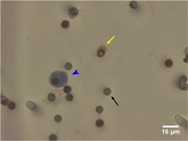 CD144 (VE-cadherin) Antibody in Immunohistochemistry (IHC)