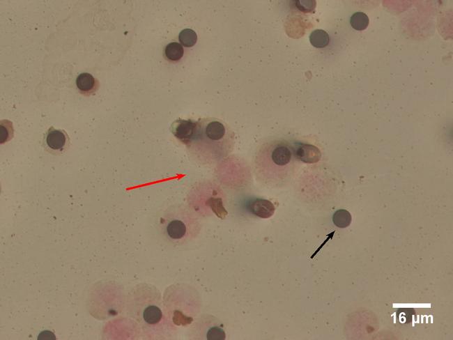 CD144 (VE-cadherin) Antibody in Immunocytochemistry (ICC/IF)