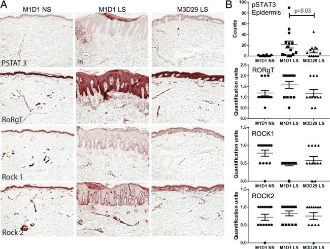 ROR gamma (t) Antibody in Immunohistochemistry (IHC)