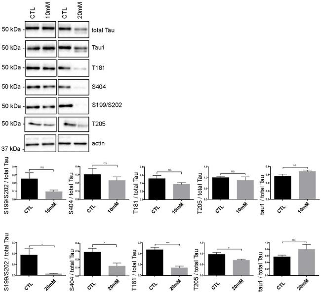 Phospho-Tau (Ser404) Antibody