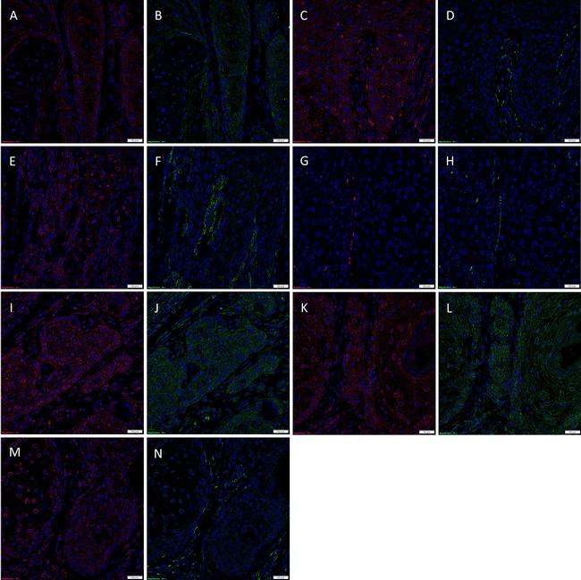 SOX2 Antibody in Immunocytochemistry (ICC/IF)