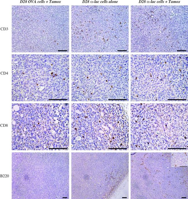 CD8a Antibody in Immunohistochemistry (IHC)