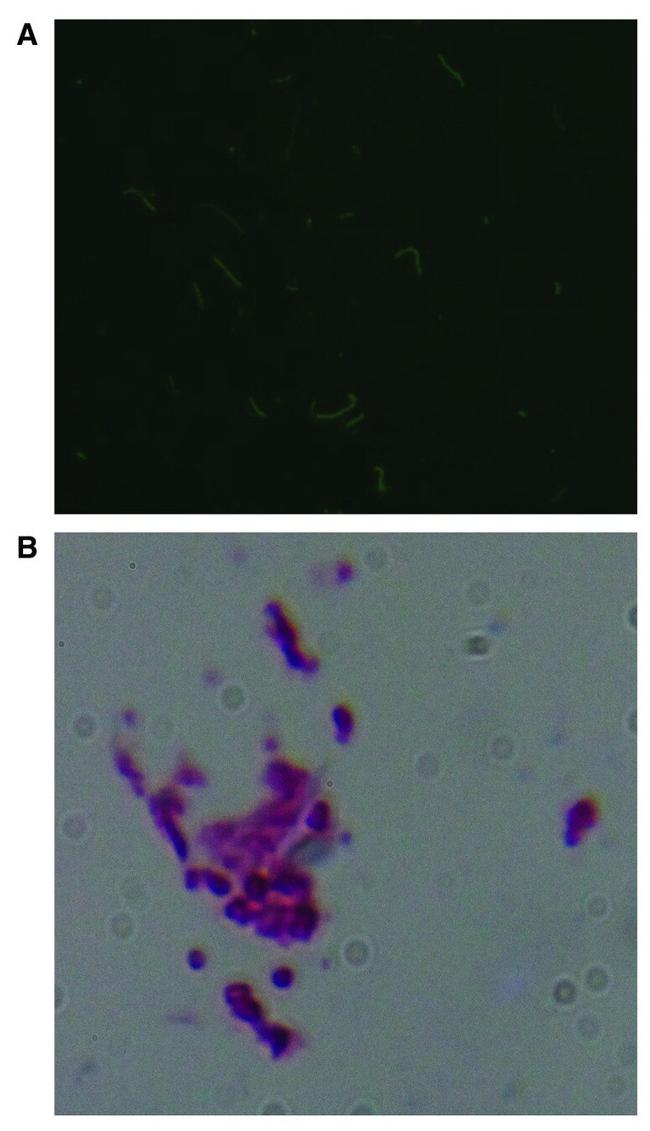 Borrelia burgdorferi Antibody in Immunocytochemistry (ICC/IF)