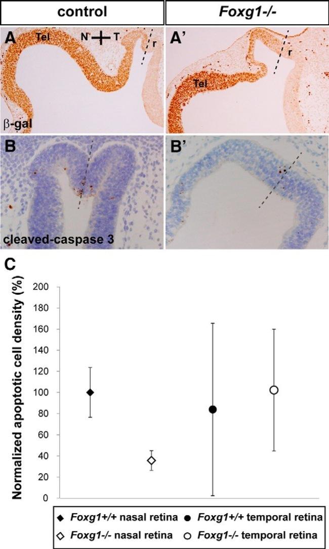 beta Galactosidase Antibody in Immunohistochemistry (IHC)