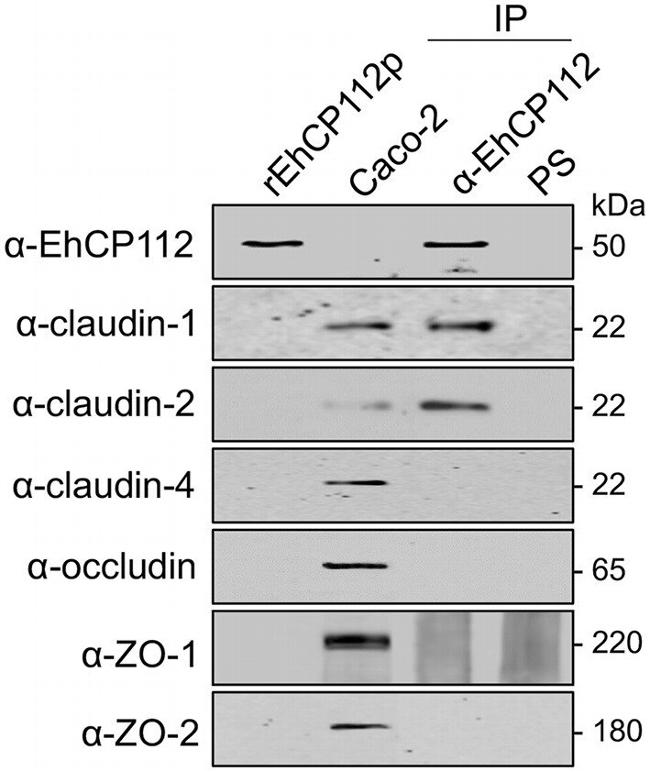 ZO-2 Antibody in Western Blot (WB)