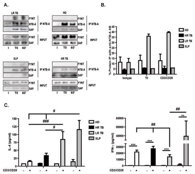 SAP (SLAM-Associated Protein) Antibody in Western Blot (WB)