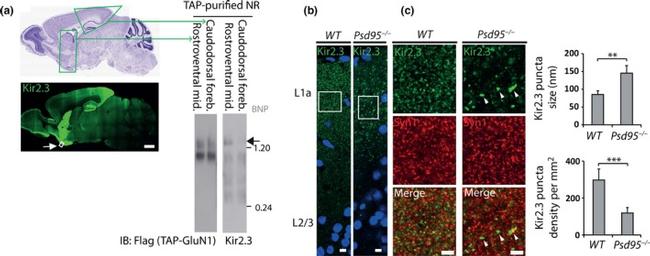 Synapsin 1 Antibody in Immunohistochemistry (IHC)