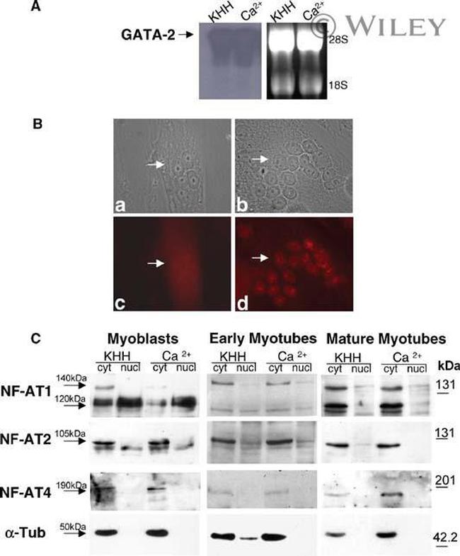 NFATC1 Antibody in Western Blot (WB)