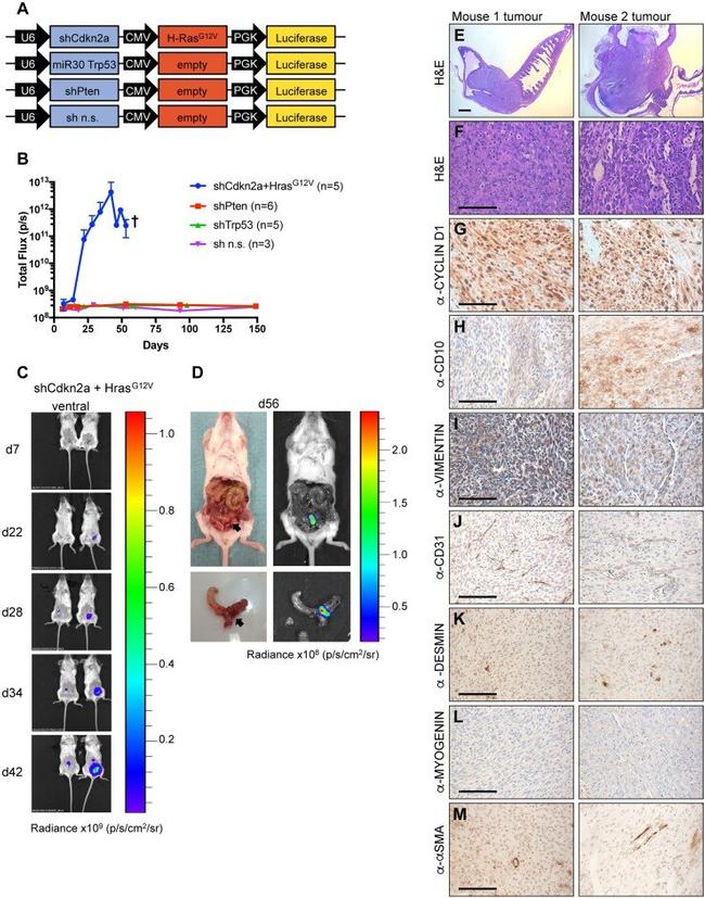 CD10 Antibody in Immunohistochemistry (IHC)