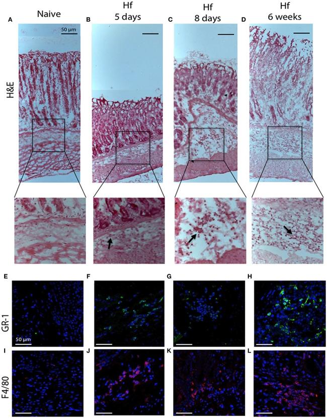 Ly-6G/Ly-6C Antibody in Immunohistochemistry (IHC)