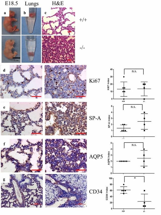 CD34 Antibody in Immunohistochemistry (IHC)