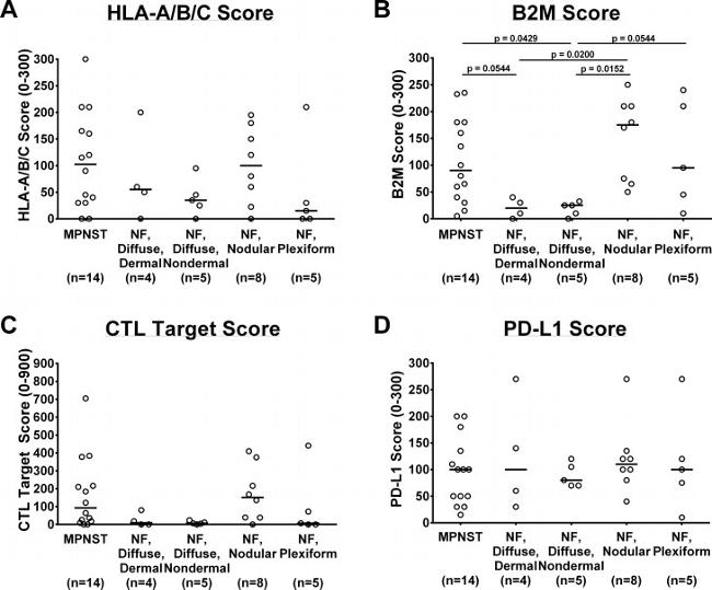 HLA-ABC Antibody in Immunohistochemistry (IHC)