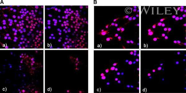 VEGF Receptor 1 (soluble) Antibody in Immunocytochemistry (ICC/IF)