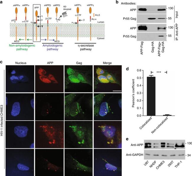 Amyloid Precursor Protein Antibody in Immunocytochemistry (ICC/IF)