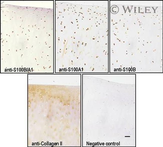 S100A1 Antibody in Immunohistochemistry (IHC)