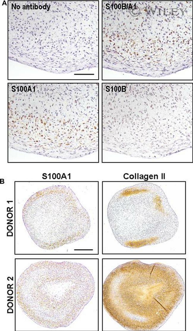 S100A1 Antibody in Immunohistochemistry (IHC)