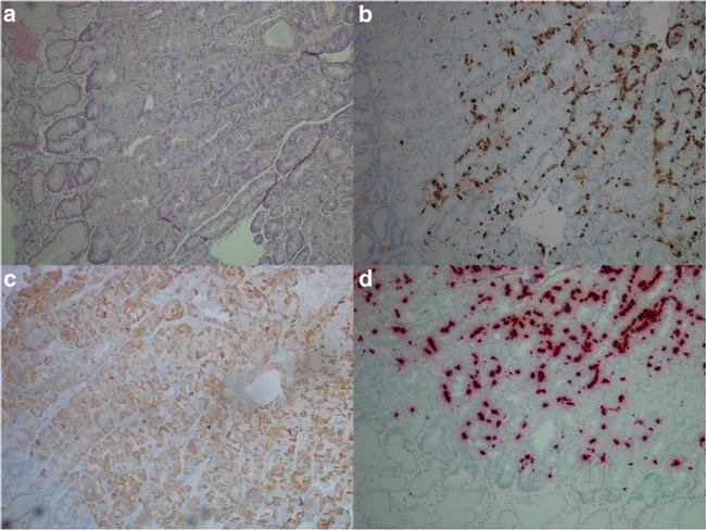 CCKBR Antibody in Immunohistochemistry (IHC)