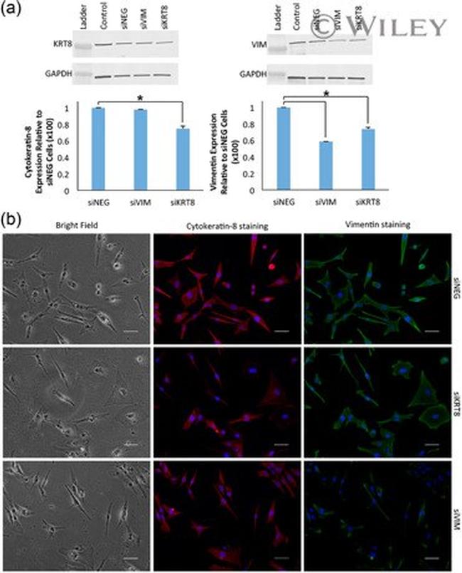 Vimentin Antibody in Immunocytochemistry (ICC/IF)