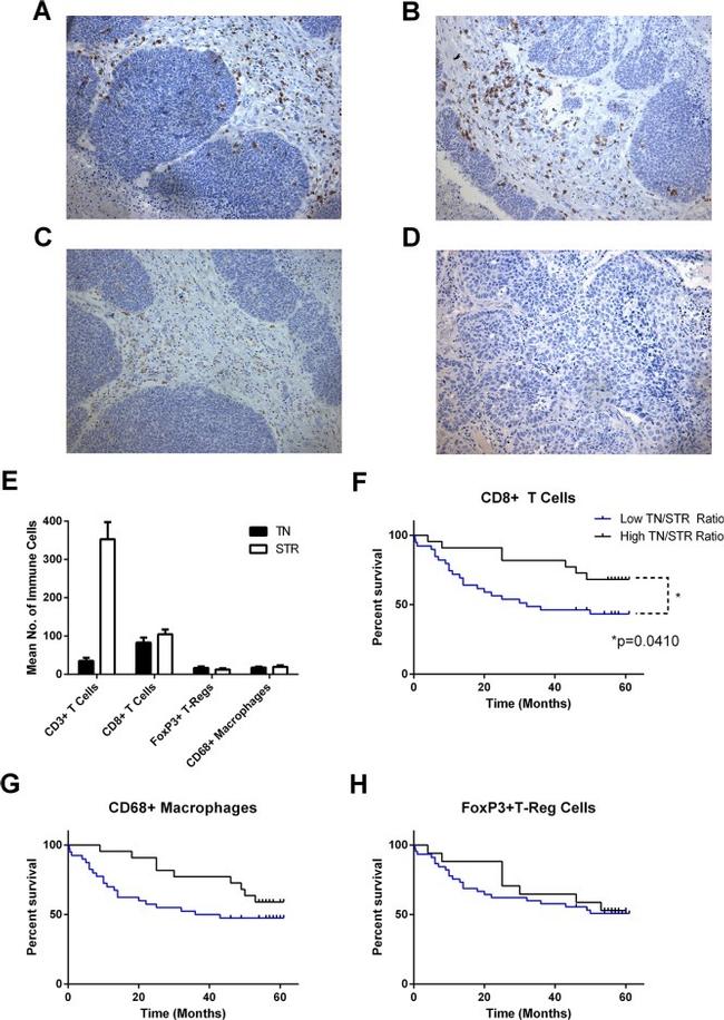 FOXP3 Antibody in Immunohistochemistry (IHC)