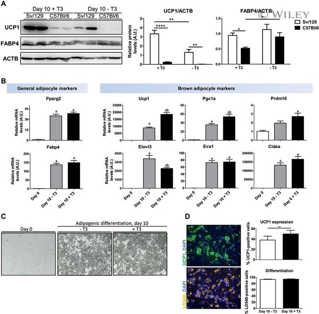 UCP1 Antibody in Immunocytochemistry, Immunohistochemistry (Paraffin) (ICC/IF, IHC (P))