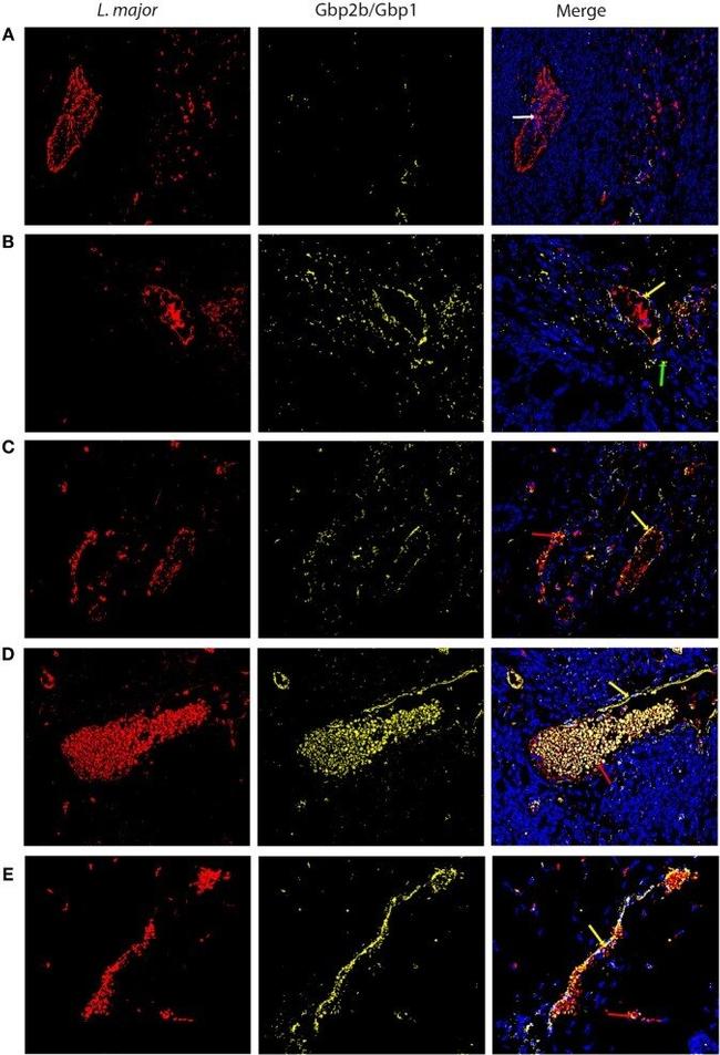 GBP1 Antibody in Immunocytochemistry, Immunohistochemistry (ICC/IF, IHC)