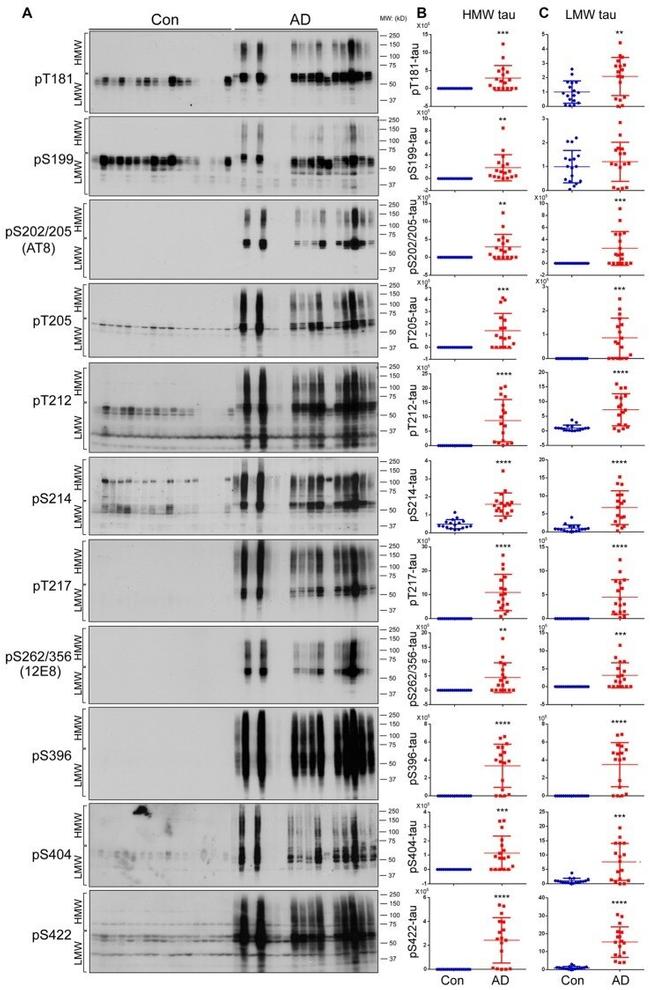 Phospho-Tau (Ser199) Antibody in Western Blot (WB)