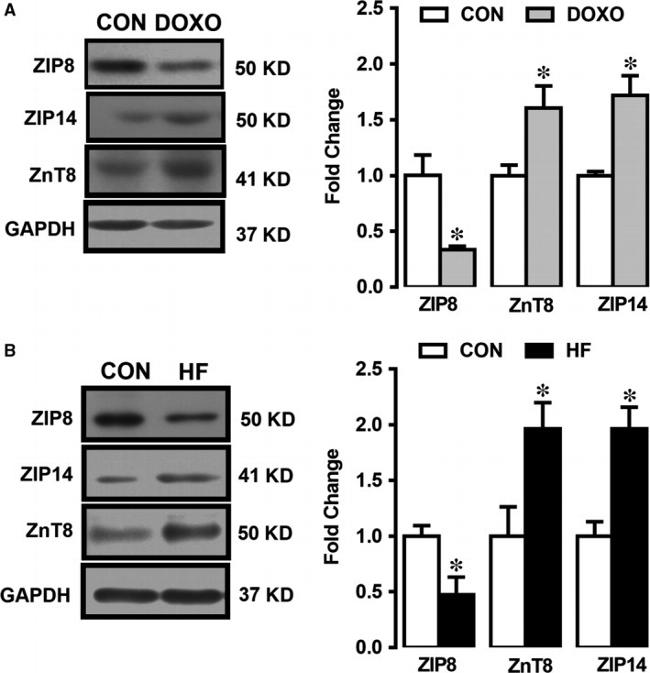 ZIP14 Antibody in Western Blot (WB)