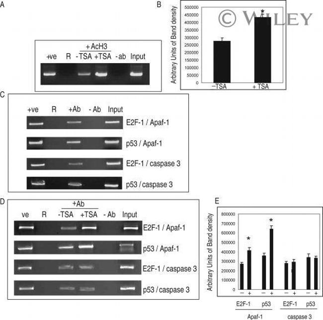 E2F1 Antibody in Immunoprecipitation (IP)