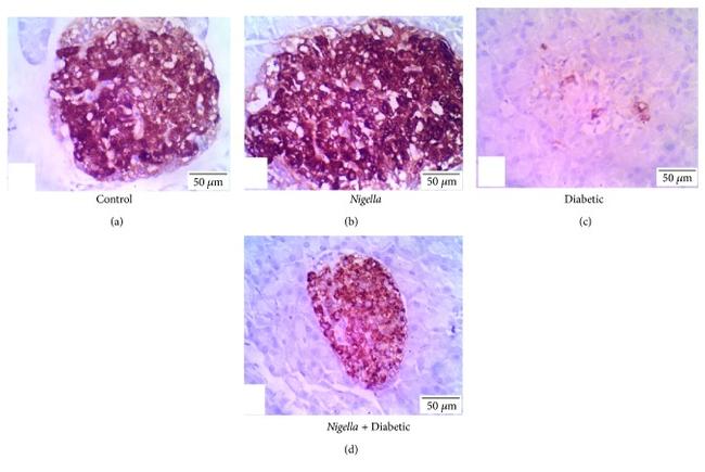 Insulin Antibody