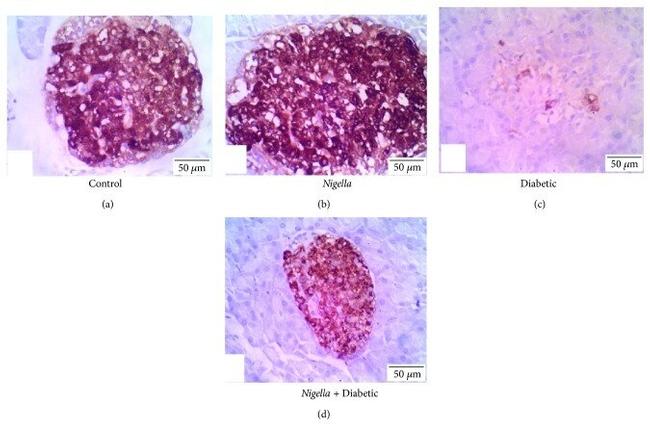 Insulin Antibody in Immunohistochemistry, Immunohistochemistry (Paraffin) (IHC, IHC (P))