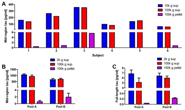 Tau Antibody in ELISA (ELISA)