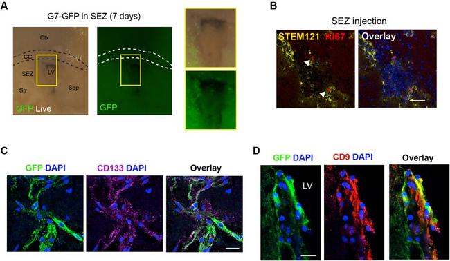 CD9 Antibody in Immunohistochemistry (IHC)