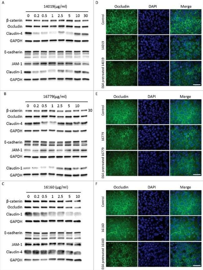 beta Catenin Antibody in Western Blot (WB)