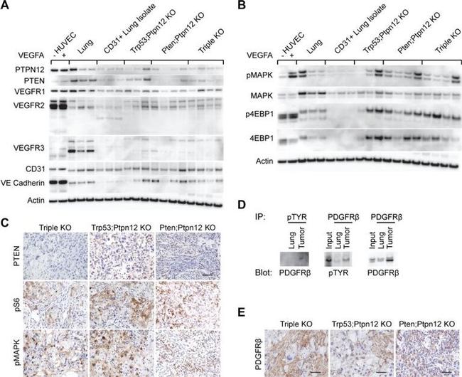 VEGF Receptor 3 Antibody in Western Blot (WB)