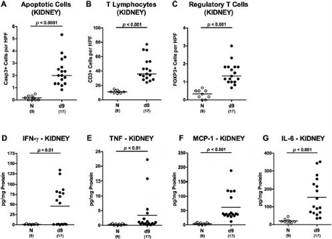 FOXP3 Antibody in Immunohistochemistry (IHC)