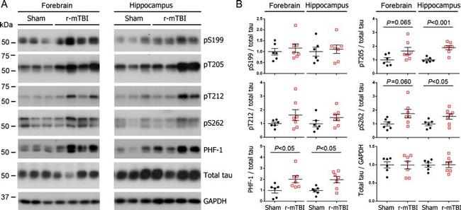 Phospho-Tau (Ser262) Antibody in Western Blot (WB)