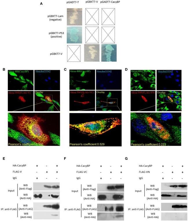 DYKDDDDK Tag Antibody in Immunoprecipitation (IP)