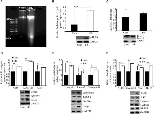 SQSTM1 Antibody in Western Blot (WB)