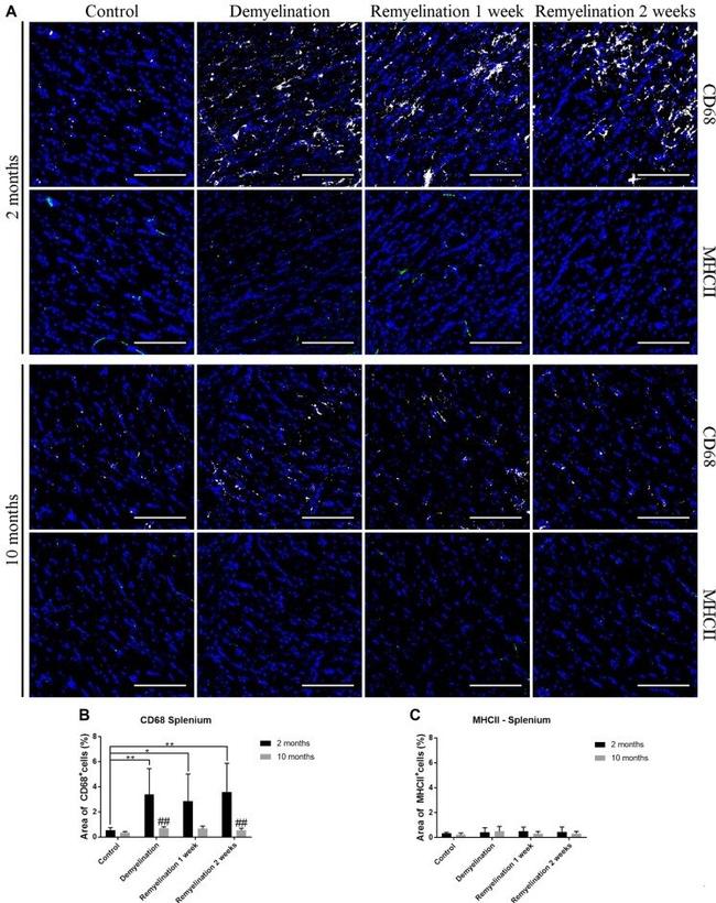 MHC Class II (I-A/I-E) Antibody in Immunocytochemistry, Immunohistochemistry (ICC/IF, IHC)