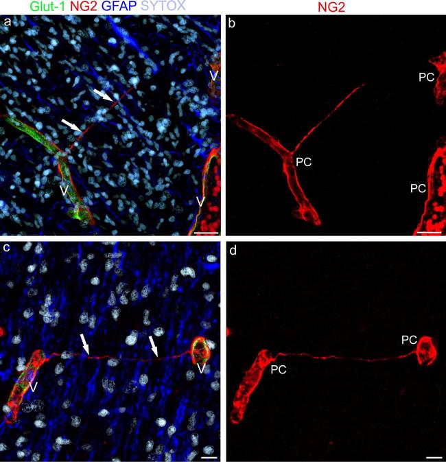 Neural/Glial Antigen 2 (NG2) Antibody in Immunohistochemistry (IHC)