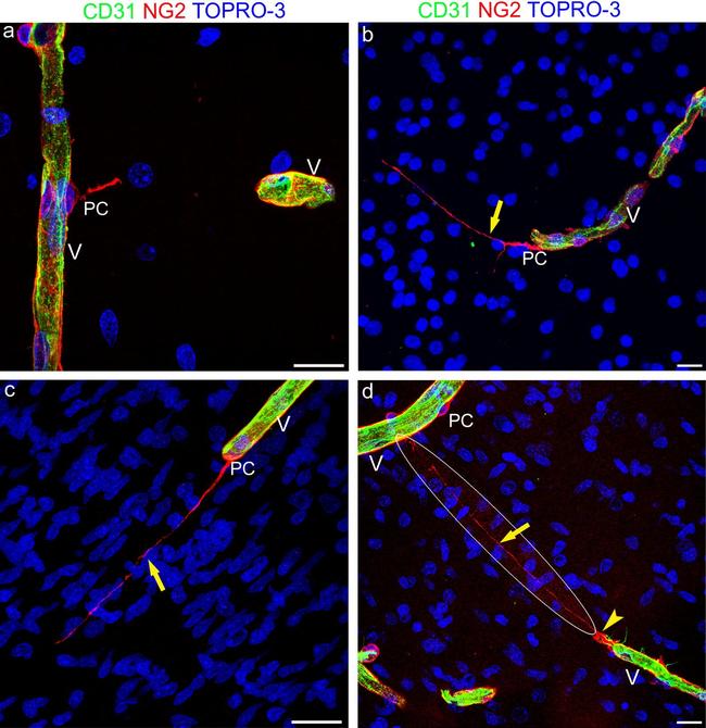 Neural/Glial Antigen 2 (NG2) Antibody in Immunohistochemistry (IHC)