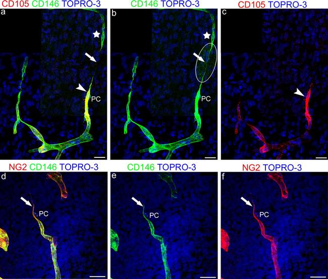 Neural/Glial Antigen 2 (NG2) Antibody in Immunocytochemistry (ICC/IF)