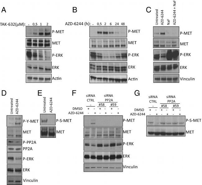 Phospho-c-Met (Ser985) Antibody in Western Blot (WB)