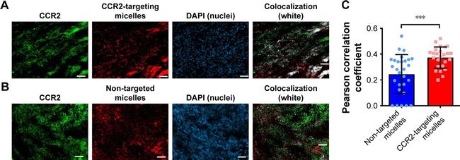 CCR2 Antibody in Immunocytochemistry, Immunohistochemistry (ICC/IF, IHC)