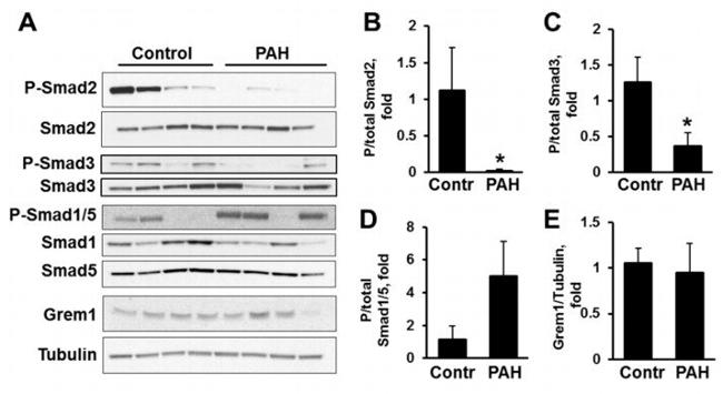 GREM1 Antibody in Western Blot (WB)