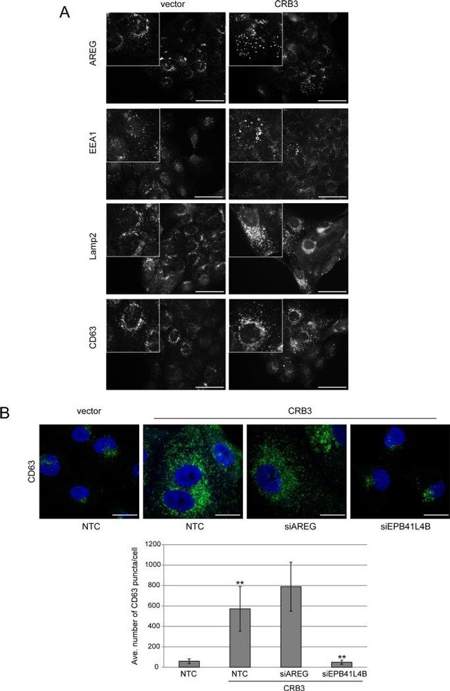 LAMP2 Antibody in Immunocytochemistry (ICC/IF)