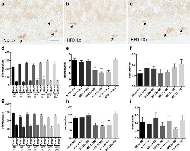 HuC/HuD Antibody in Immunohistochemistry (IHC)