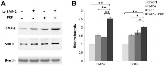 beta Actin Antibody in Western Blot (WB)