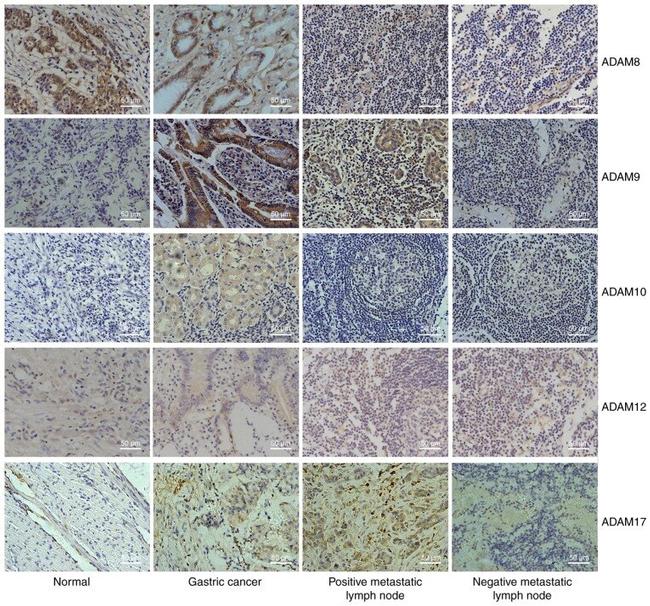 ADAM9 Antibody in Immunohistochemistry (IHC)