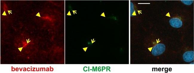 IGF2R Antibody in Immunocytochemistry (ICC/IF)